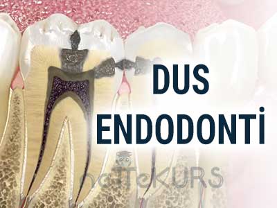 Online DUS Endodonti Dersleri, DUS Endodonti Uzaktan Eğitim Dersleri